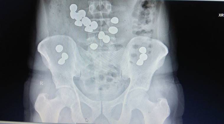 gold, federal reserve gold, federal reserve