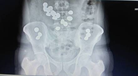 gold, federal reserve