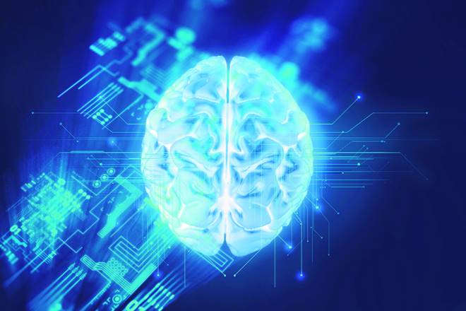 intel, profit forecast