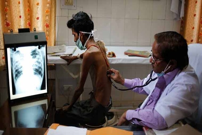 India, TB, india tops TB list, WHO, tuberculosis