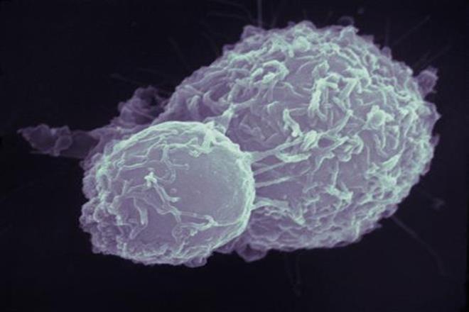 cancer cells, UK, Pingyu Zhang, organic material, University of Warwick, deadly version of oxygen, lung cancer cells