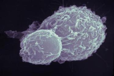 cancer cells, UK, Pingyu Zhang, organic material, University of Warwick, deadly version of oxygen, lung cancer cells