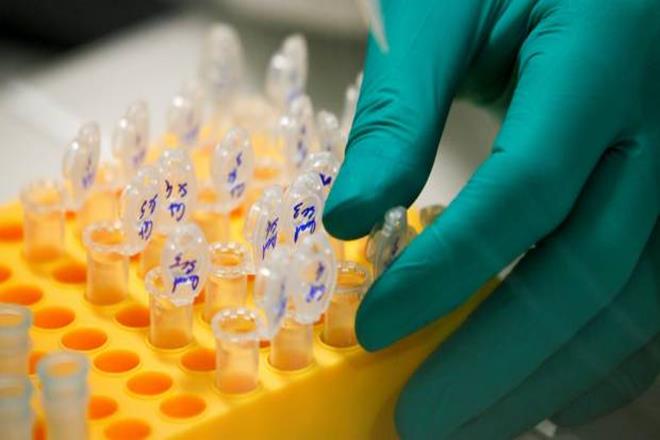 Novel gene therapy, US, Leber congenital amaurosis, retina,  Ophthalmologist, US Food and Drug Administration, retinal disease