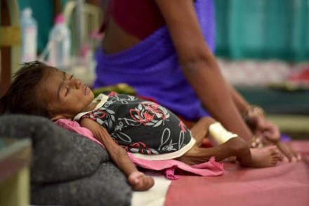 India, Mexico, China, South Africa, Brazil, malnutrition