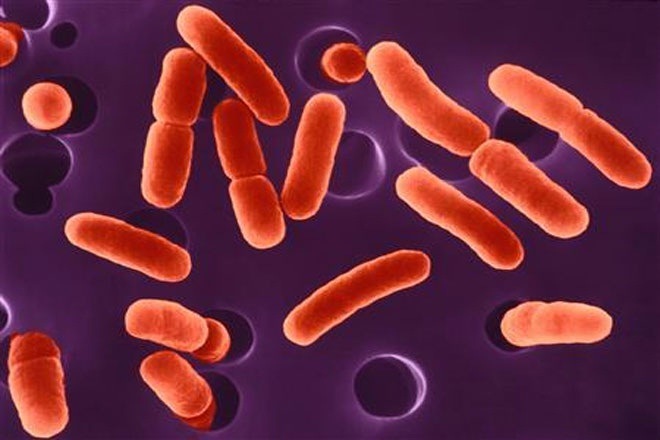 Artificial intelligence, bacteria, BIDMC, US, Beth Israel, E coli, AI system, AI-enhanced microscope system, microbiologists, machine intelligence