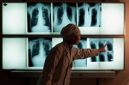 TB detection, TB disease, doctor, George Mason University