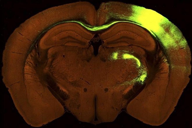map brain wiring, technology to map brain wiring, human brain, human organ, neural connection, science, health