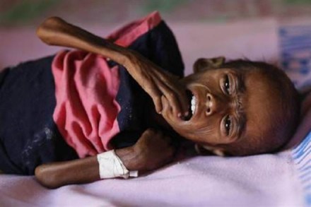 GDP, india economy, economy fall, GDP fall, GDP loss, health problems, India, India Malnutrition, underweight, Niti Aayog, Swachh Bharat, Swasth Bharat, Kuposhan, Kuposhan Mukt Bharat, Narendra Modi GDP, india economy, economy fall, GDP fall, GDP loss, health problems, India, India Malnutrition, underweight, Niti Aayog, Swachh Bharat, Swasth Bharat, Kuposhan, Kuposhan Mukt Bharat, Narendra Modi