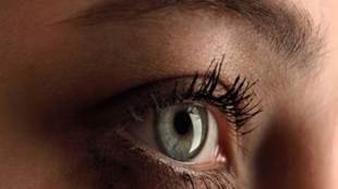 US woman found with eye disease previously found only in cattle