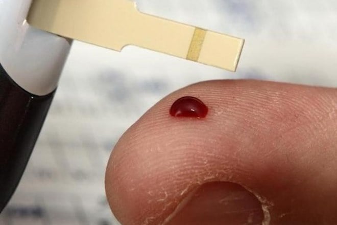 diabetes, diabetes tips, diabetes symptoms, how to treat diabetes, dental health, news on diabetes