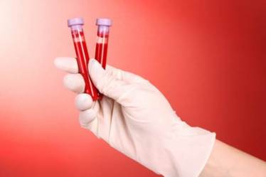 blood test, brain injury, brain trauma, banyan brain trauma indicator, neurology