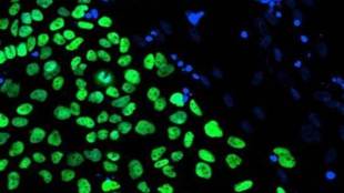 stem cell