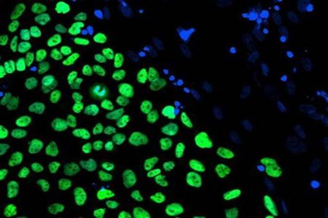 stem cell stem cell