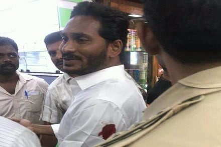  Jagan Mohan Reddy was bleeding from left arm. (ANI image) 