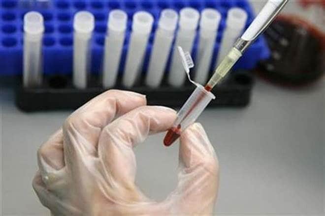 health, chemotherapy, chemotherapy, latest news, important news