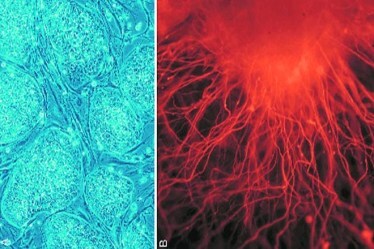 This new stem cell technique may help fight cancer, finds study