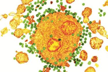HIV, hiv cure, HIV1, aids cure, aids, aids full form, aids day, aids cure, aids symptoms, aids disease