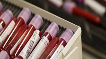Stating the tests for diagnosing Hemophilia are not expensive and can be done at district hospitals, Kashyap explained that there are two types of tests -- Activated Partial Thromboplastin Time (APTT) Test and Prothrombin Time (PT) Test.