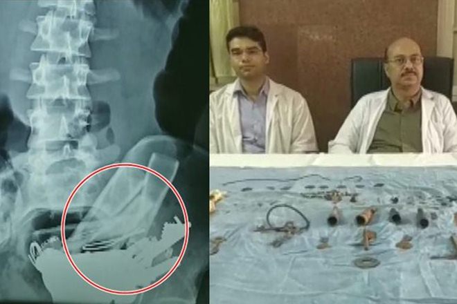 encephalitis, doctors strike, chamki bukhar, encephalitis meaning, acute encephalitis syndrome, muzaffarpur, shashi tharoor, chamki fever, aes disease, encephalitis causes, aes, japanese encephalitis, encephalitis syndrome, bihar temperature, what is encephalitis, bihar news in hindi, chamki bukhar in english, acute encephalitis, encephalitis symptoms, lychee death, brain fever, monsoon in bihar, encephalitis in bihar, bihar child death encephalitis, doctors strike, chamki bukhar, encephalitis meaning, acute encephalitis syndrome, muzaffarpur, shashi tharoor, chamki fever, aes disease, encephalitis causes, aes, japanese encephalitis, encephalitis syndrome, bihar temperature, what is encephalitis, bihar news in hindi, chamki bukhar in english, acute encephalitis, encephalitis symptoms, lychee death, brain fever, monsoon in bihar, encephalitis in bihar, bihar child death