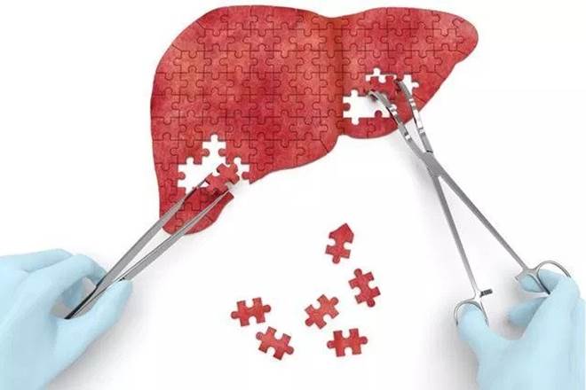 Hepatitis B (Source: Thinkstock Images)