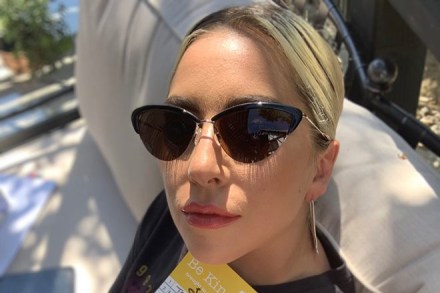 Earlier, Lady Gaga had a fall off the stage on Thursday night, following which he had her entire body X-rayed and shared the update on Twitter. (Image: Twitter)