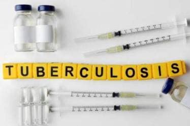 From 1998 to 2015, the concept of a high burden country, or HBC, became widely used in the context of TB. 