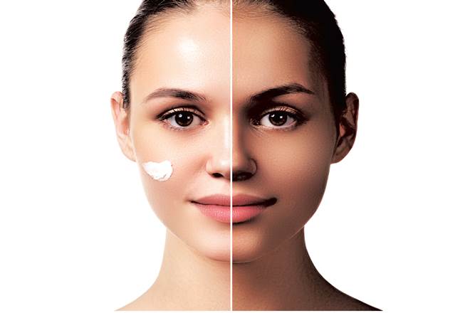 Fair skin tone, Colour sickness, fair bride, fair groom, fairness creams, skin tone, dark skin tone, light-skinned, Fair and Lovely