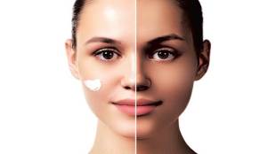 Fair skin tone, Colour sickness, fair bride, fair groom, fairness creams, skin tone, dark skin tone, light-skinned, Fair and Lovely