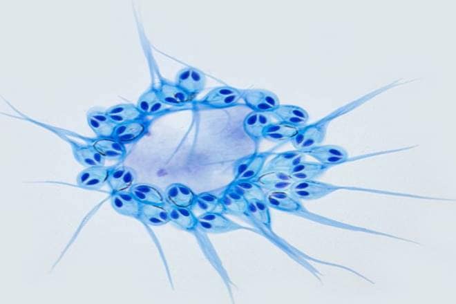 Big discovery! First animal to survive without oxygen found