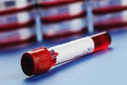 blood, flood transfusion