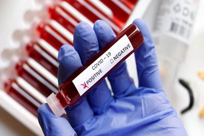 "SII will be manufacturing the vaccine in anticipation of clinical trials succeeding by September-October in the UK," Adar Poonawalla, CEO, Serum Institute, said.