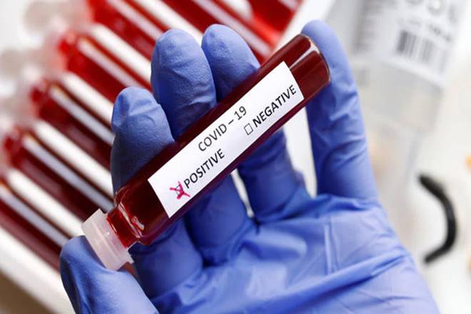 Coronavirus pattern emerges in country: 80% cases reported from 62 districts