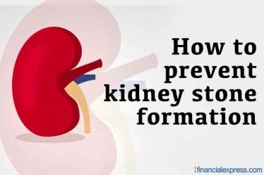 Kidney stone prevention, how to prevent kidney stone, how to treat kidney stone without surgery, Lithotripsy