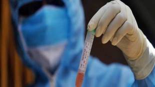 covid 19, covid 19 testing kits, covid 19 cases in india, VTM suppliers,coronavirus pandemic, RT-PCR kits,hydroxychloroquine, latest news on coronavirus outbreak