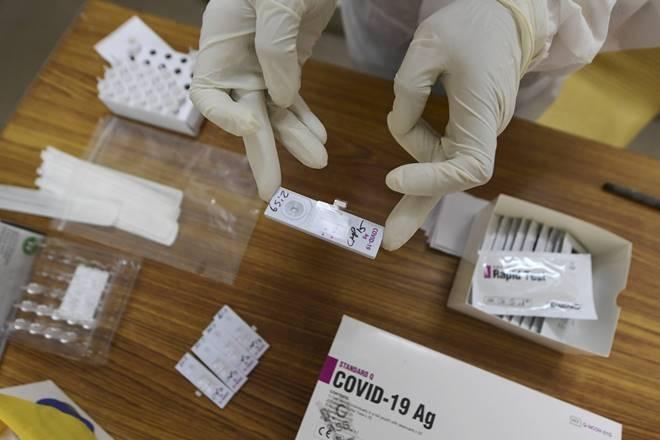 This makes the antigen test seem an attractive option as we ramp up testing. This makes the antigen test seem an attractive option as we ramp up testing.