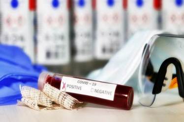 Covid: Mapmygenome, Apollo Clinic offer DNA-based tests