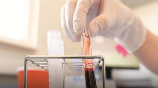 He said advertisements have been put out by the hospital authorities to hire trained technicians.