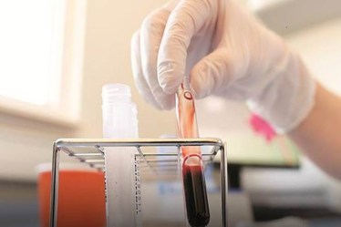 He said advertisements have been put out by the hospital authorities to hire trained technicians.