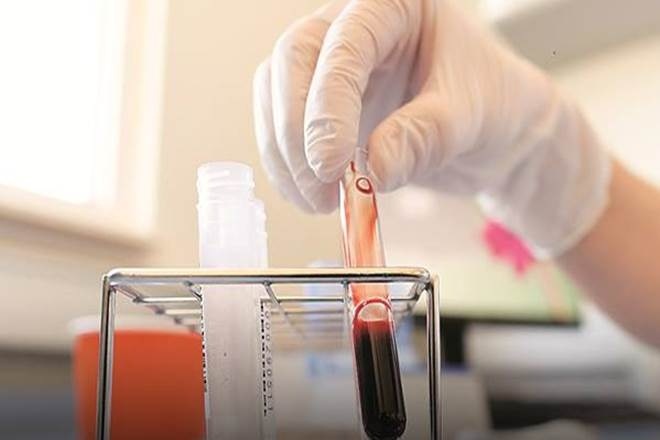 He said advertisements have been put out by the hospital authorities to hire trained technicians.