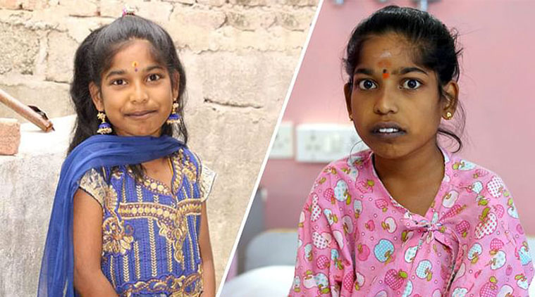 URJA president Atul Goyal said Delhi falls in seismic zone IV - a very high-risk zone.