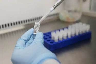 Covid-10 Treatment, Itolizumab covid 19 patients, Psoriasis injection Itolizuma, AIIMS, covid 19 syndrome, Biocon, latest news on coronavirus outbreak