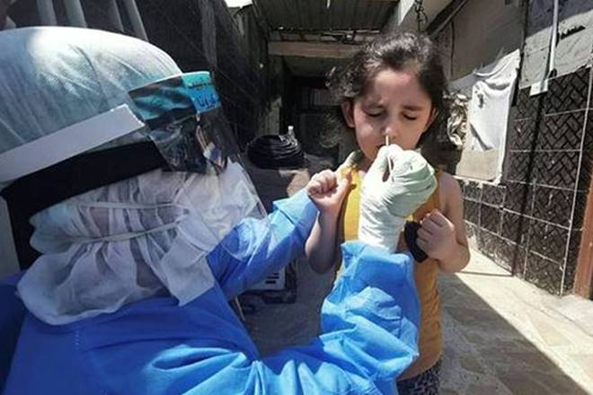 Kawasaki disease symptoms: How common is this syndrome among COVID-infected children