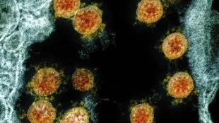 Covid-19,Hong Kong scientists, covid 19 cases in hong kong, COVID patients,covid 19 infections, immune system, latest news on coronavirus outbreak
