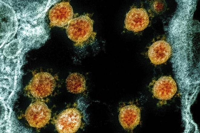 Covid-19,Hong Kong scientists, covid 19 cases in hong kong, COVID patients,covid 19 infections, immune system, latest news on coronavirus outbreak Covid-19,Hong Kong scientists, covid 19 cases in hong kong, COVID patients,covid 19 infections, immune system, latest news on coronavirus outbreak