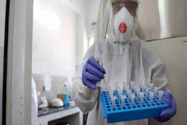 coronavirus infection, SARS-Co-V2 infection, covid 19 diagnostic kit, covid 19 cases, covid 19 research, latest news on covid 19 pandemic