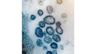 Papua New Guinea, Chinese mining company, COVID-19 vaccine, COVID-19 vaccine testing, SARS-COV-2 vaccine, latest news on coronavirus outbreak