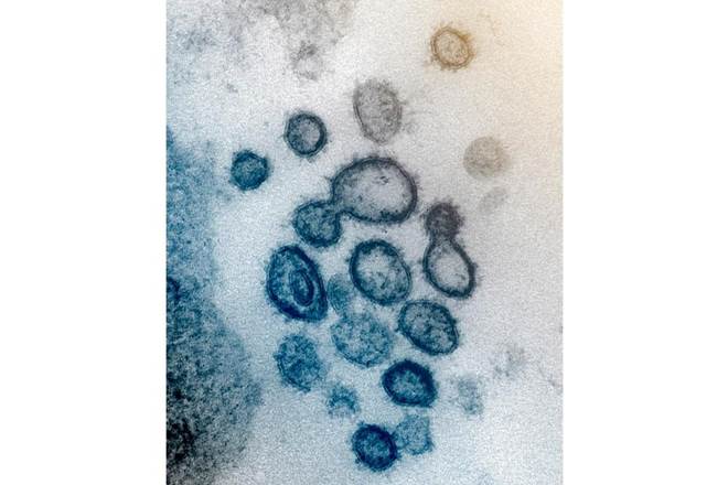 Papua New Guinea, Chinese mining company, COVID-19 vaccine, COVID-19 vaccine testing, SARS-COV-2 vaccine, latest news on coronavirus outbreak