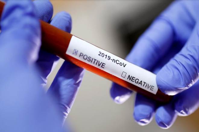 COVID tests, Travellers from India, Singapore trip, coronavirus test, coronavirus cases, PCR test, covid 19 infections, latest news on coronavirus pandemic COVID tests, Travellers from India, Singapore trip, coronavirus test, coronavirus cases, PCR test, covid 19 infections, latest news on coronavirus pandemic