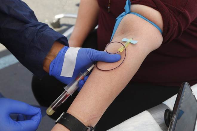 Large antibody study offers hope for coronavirus vaccine efforts Large antibody study offers hope for coronavirus vaccine efforts