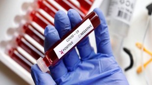 "The UT recorded 635 fresh cases of COVID-19 in the past 24 hours -- with 235 in Jammu and 400 in the Kashmir valley," the officials said.